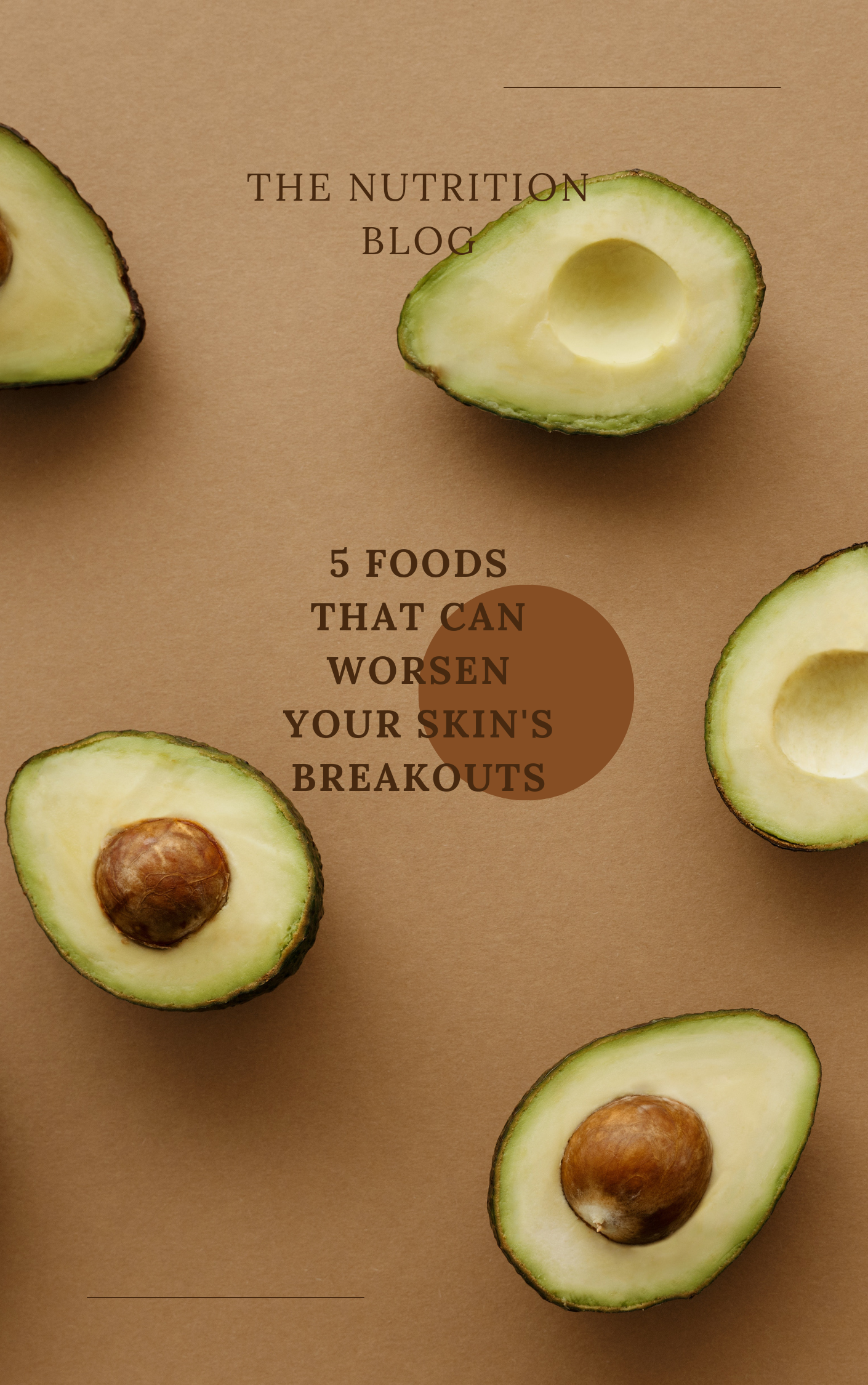 Acne Aggravators: 5 Foods That Can Worsen Your Skin's Breakouts